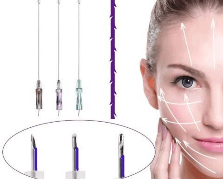 Verticalización Facial (Lifting con Hilos)