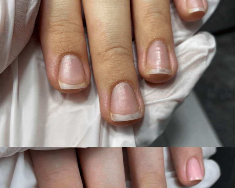 Retiro de Esmalte Permanente & Base Rubber