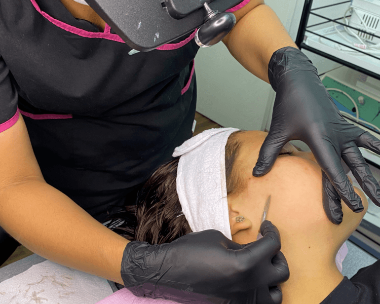 Limpieza Profunda + DERMAPLANING
