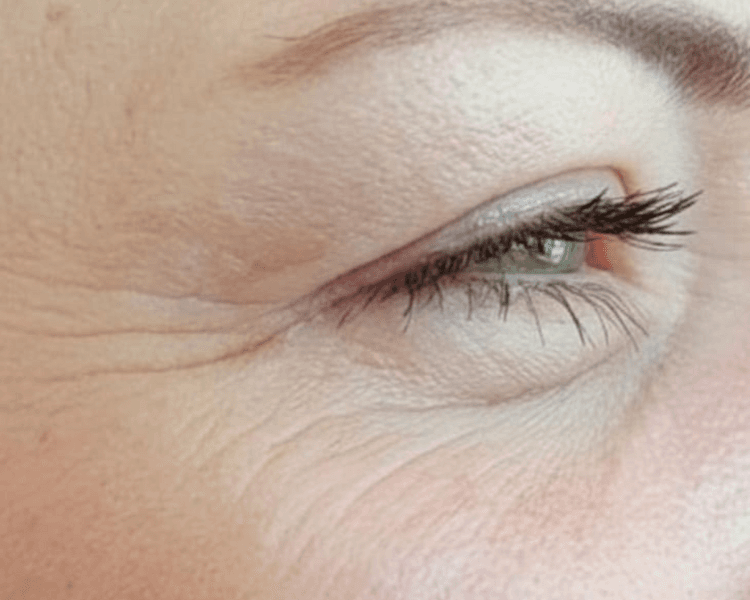 LIMPIEZA FACIAL CON TRAMAMIENTO ANTIAGE