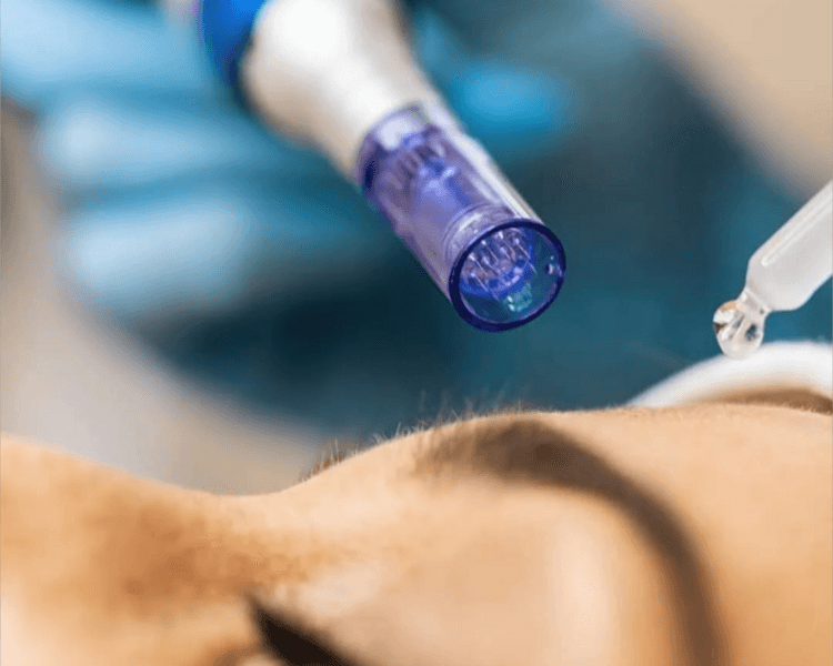 TRATAMIENTO PARA LINEAS DE EXPRESION