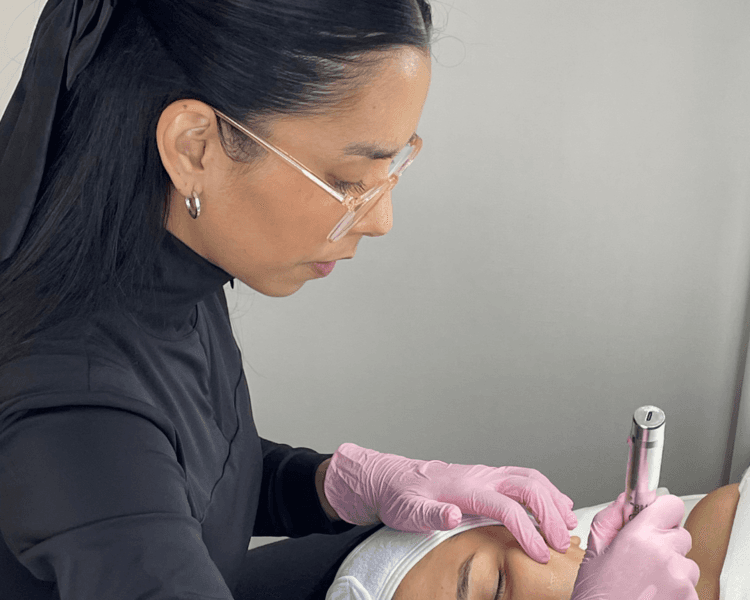 ✨ Peeling Antioxidante & Revitalizante con Dermapen ✨