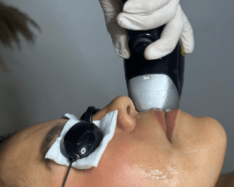 DEFINITIVA BOZO MUJER