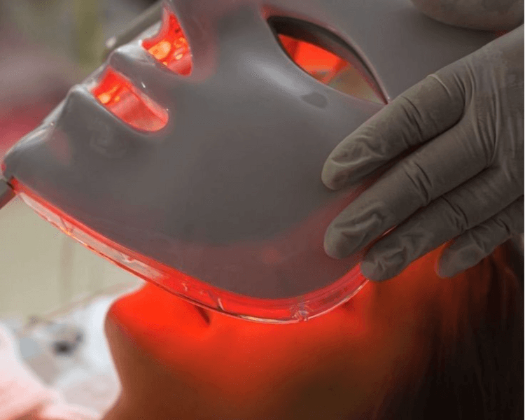 Limpieza Facial Profunda