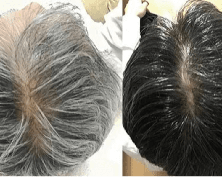 Cubrimiento De Canas