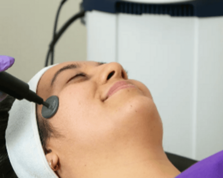 RADIOFRECUENCIA MONOPOLAR FACIAL