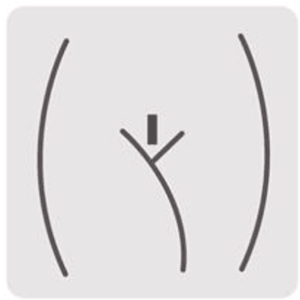 Bikini Mohican/ dama (incluye zona interglutea)