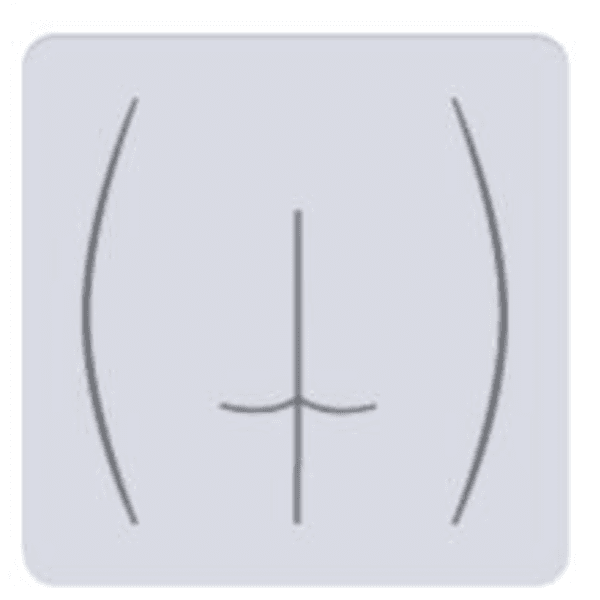 Zona Interglutea o Zona Anal/ damas