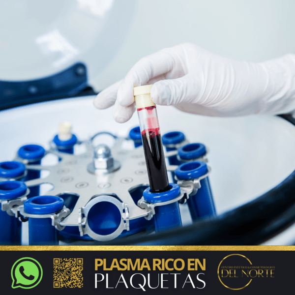 Plasma Rico en Plaquetas (FACIAL)