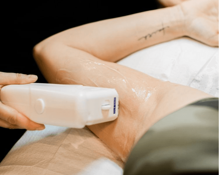 PACK DE DEPILACION LASER AXILAS + MEDIO BRAZO + REBAJE FULL