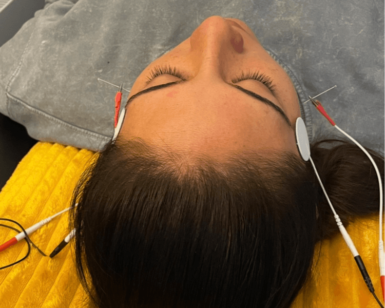 SESIÓN KINESICA MAXILOFACIAL - TRATAMIENTO