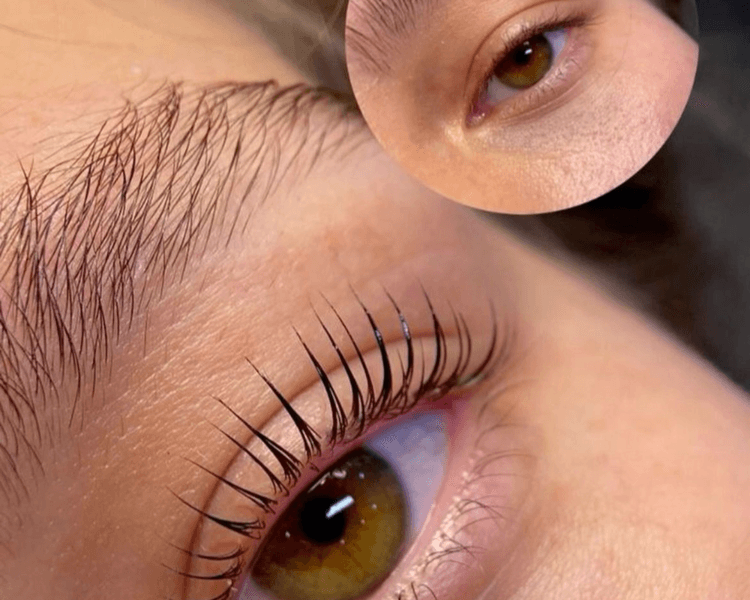 Lifting de pestañas