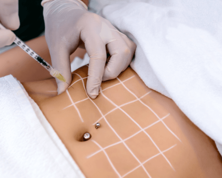 Paquete Reductivo Slim Balance