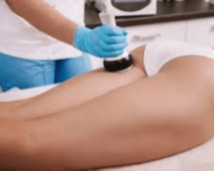 Tratamiento Celulitis