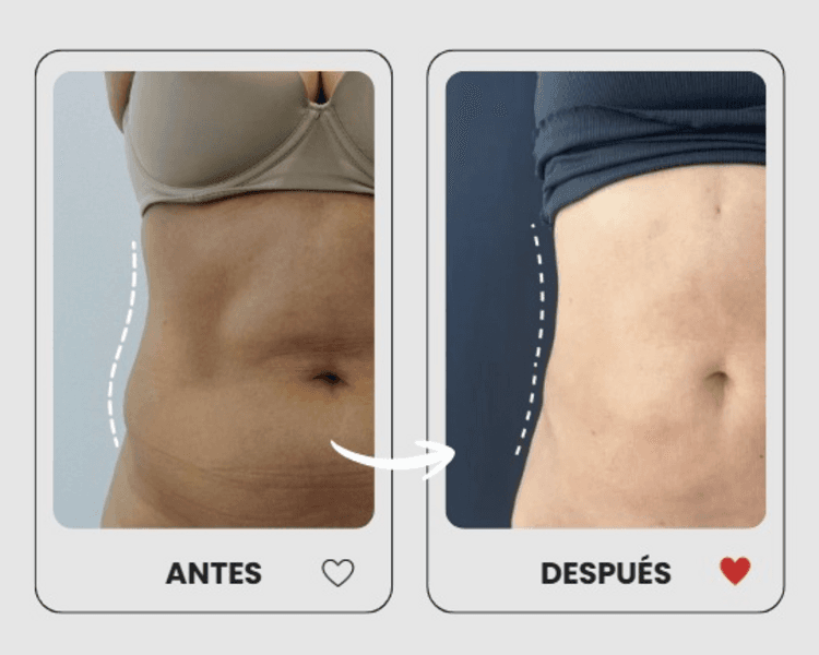 Evaluación Medicina Estética Corporal