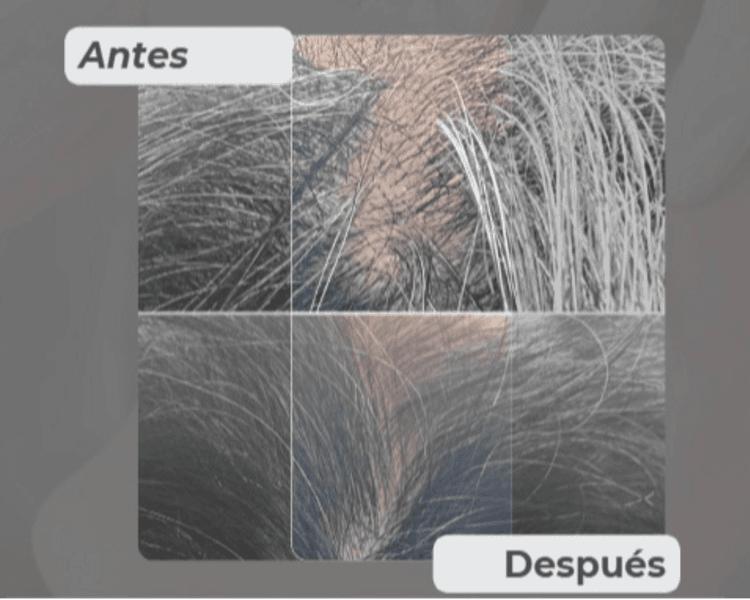 Bioregenerador Capilar