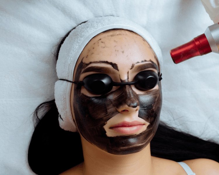 PICOLÁSER HOLLYWOOD PEEL