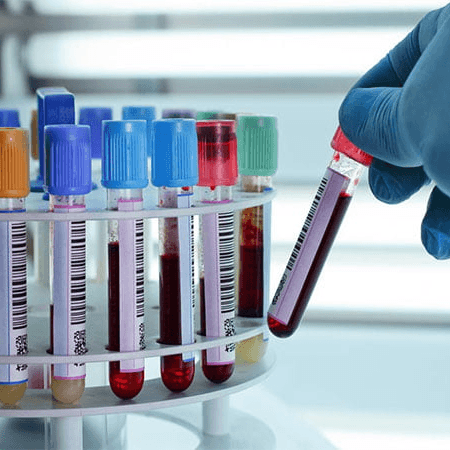 EXAMENES DE LABORATORIO photo