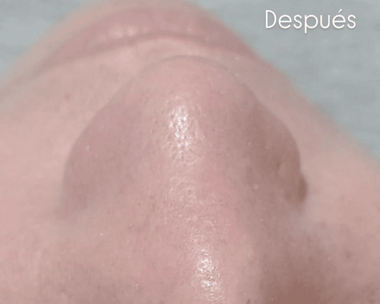 ✨ Tratamiento Facial Personalizado