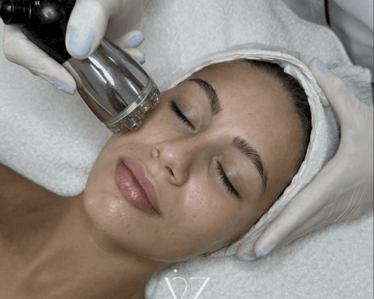 LIMPIEZA FACIAL PROFUNDA CON RADIOFRECUENCIA