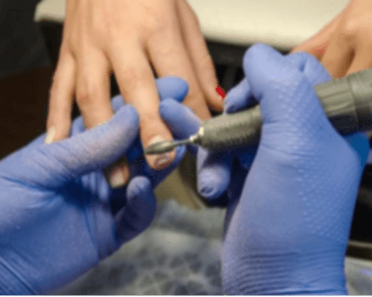 Reparación de 1 uña