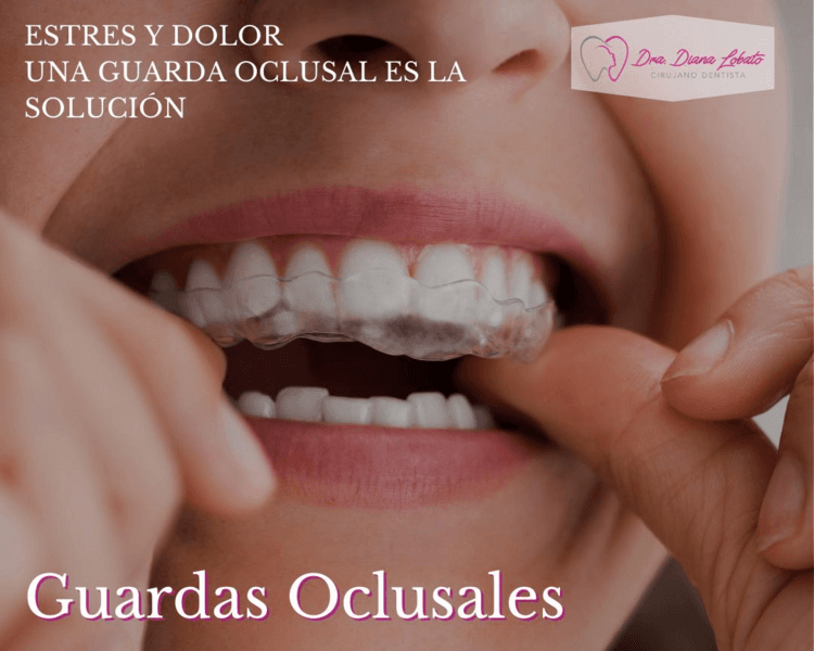 Guarda Oclusal