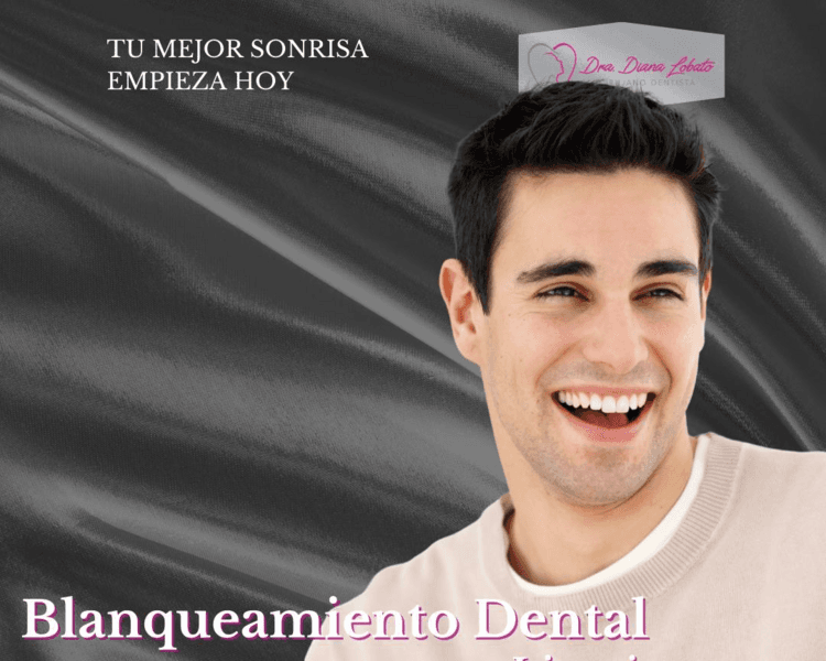 Blanqueamiento Dental