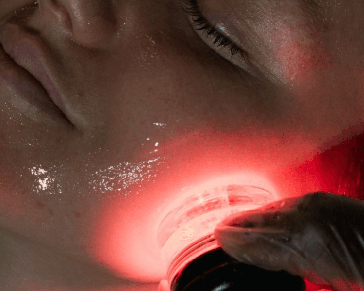 Limpieza Facial Efecto Lifting