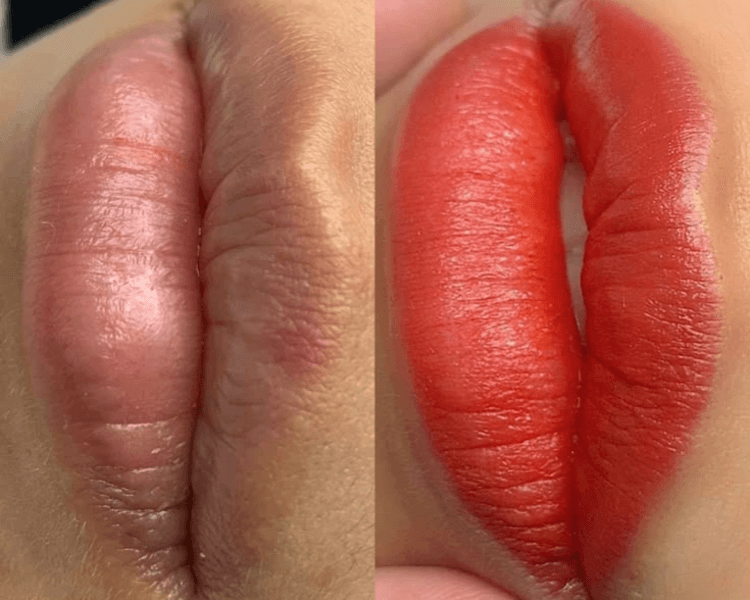 Neutralización y micropigmentación de labios