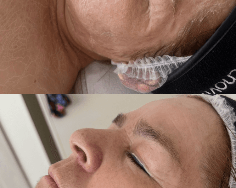 Ritual Tensor Lifting Pro