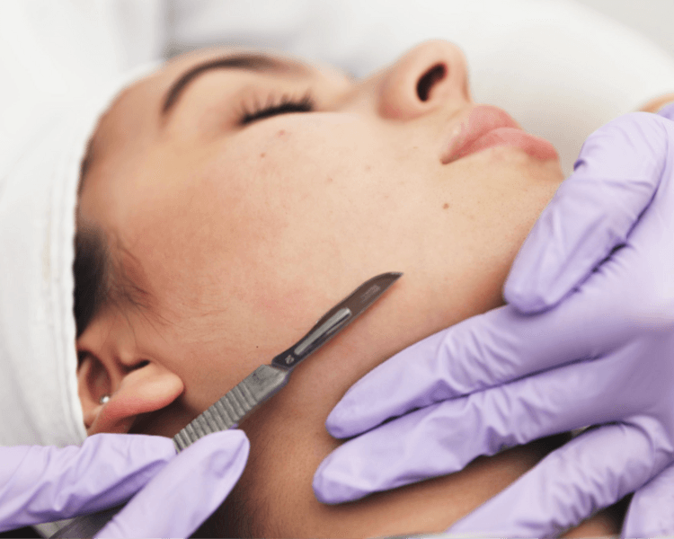 Limpieza facial + Peeling manual (Dermaplaning)