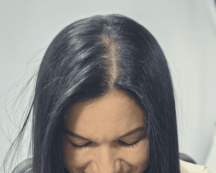 Tarjeta VIP terapias capilares