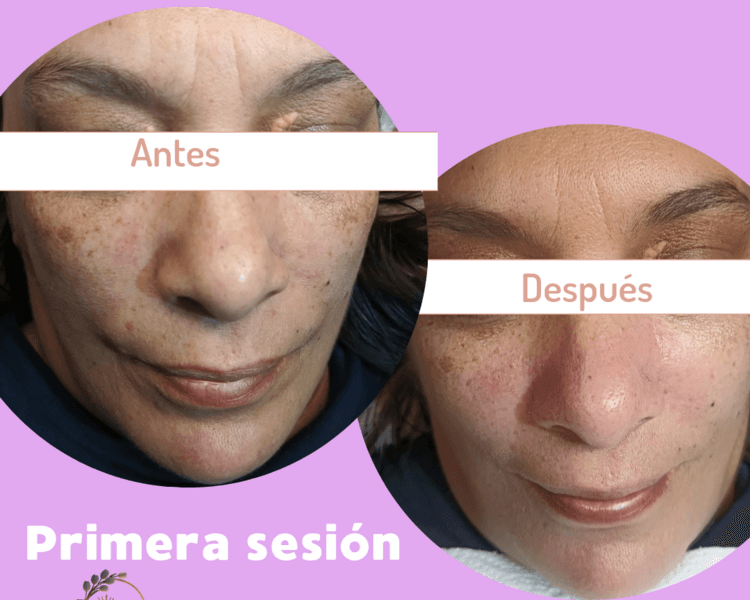 Limpieza facial básica