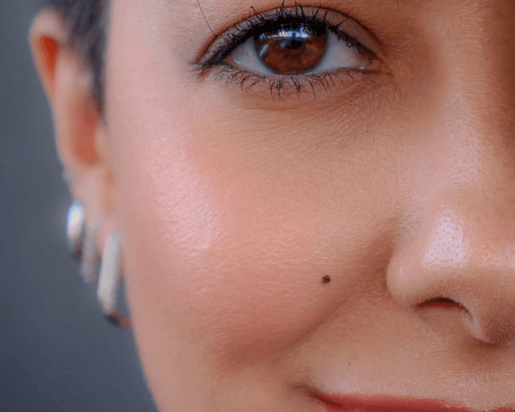 Micro Lunar esteticos