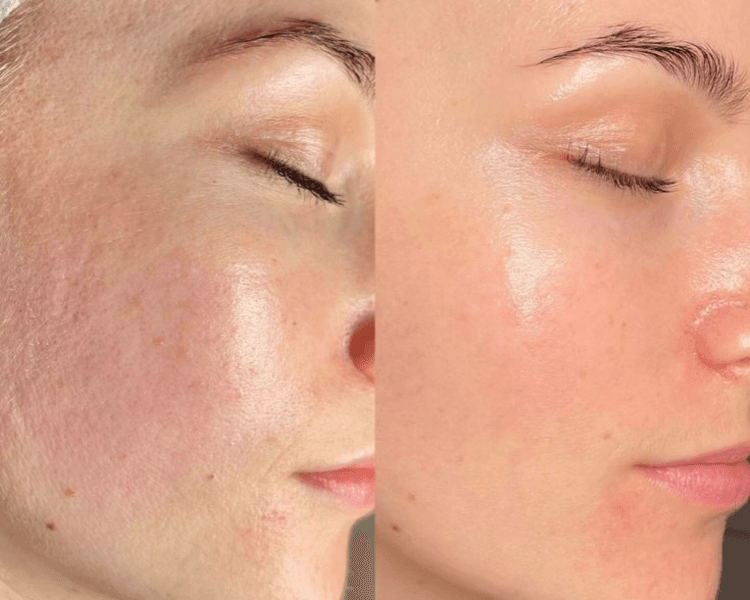 Revitalizante Facial