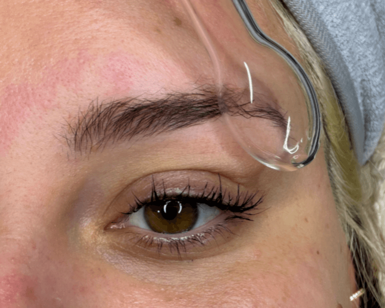 RESTAURACIÓN DE CEJAS CON EXOSOMAS