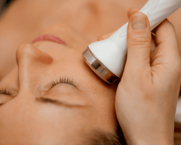 Limpieza Profunda con Radiofrecuencia Facial