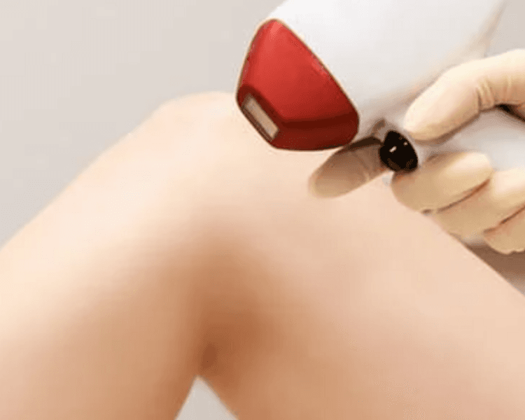 Depilación definitiva PIERNAS COMPLETAS