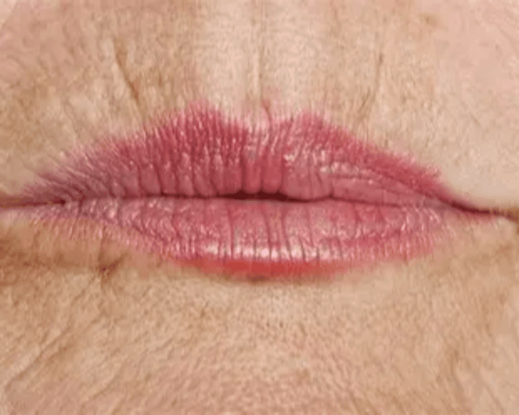 Código de Barras · Alisado del Contorno Labial