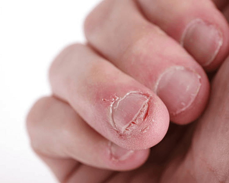 Manicure Semi permanente con vitamina