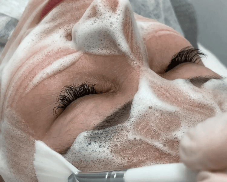Limpieza facial