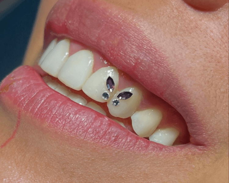 Mariposa figura (4 Gems)