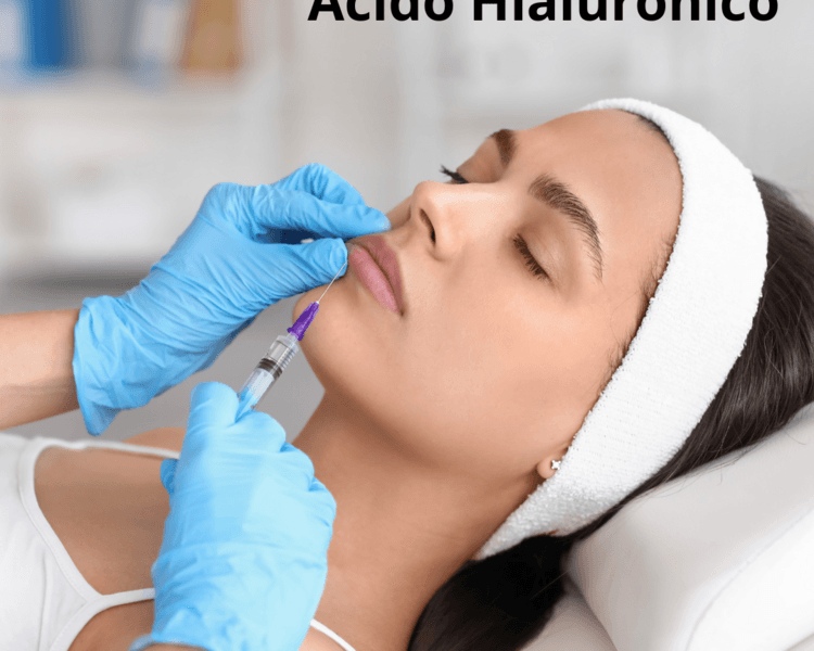 Acido Hialuronico