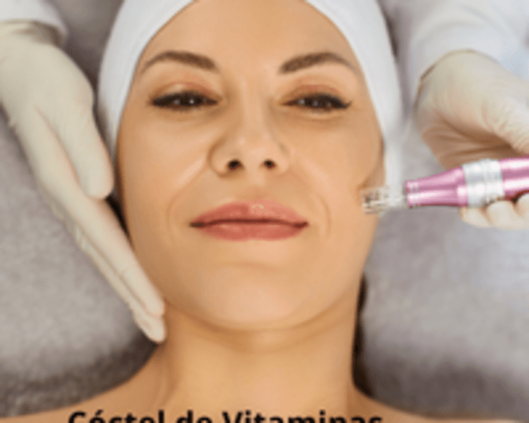 Limpieza Facial Profunda + Microneedling (cóctel de vitaminas)