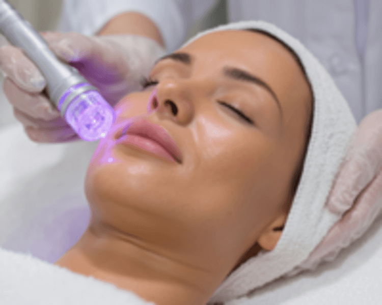 Radiofrecuencia Facial