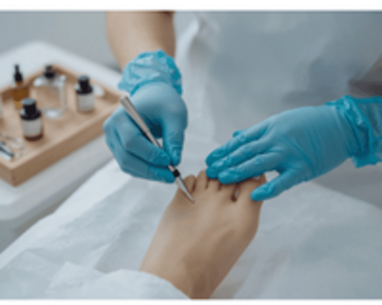 Curacion de Pie Diabetico