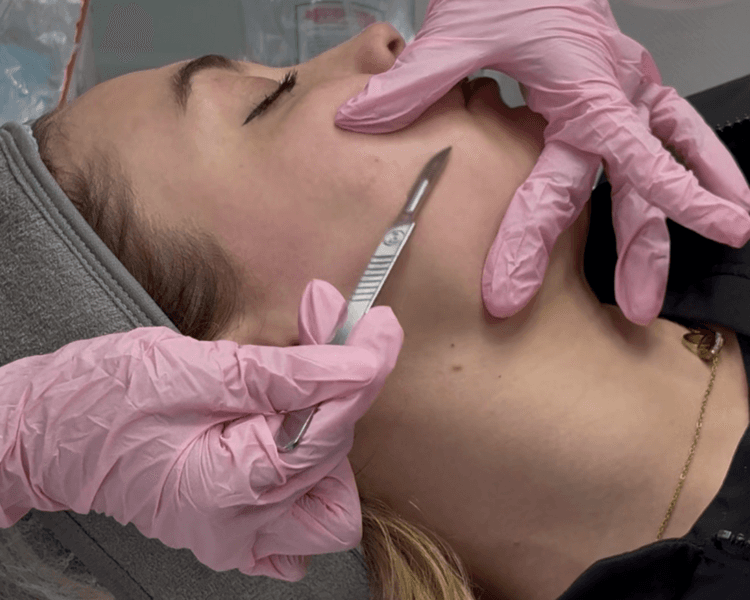 Limpieza facial + dermaplaning