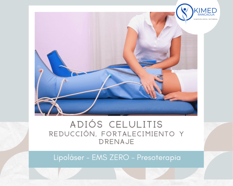 Adiós Celulitis – Reducción, Fortalecimiento y Drenaje en Muslos