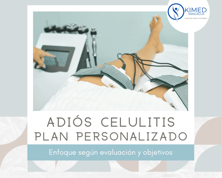 Adiós Celulitis – Plan Personalizado en Muslos