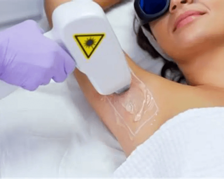 ✨ 10 Sesiones de Depilación Láser en AXILAS, BIKINI BASICO ó ABDOMEN